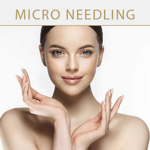 micro-needling